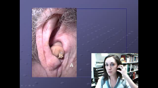 Hearing Aid Fitting, Part 2