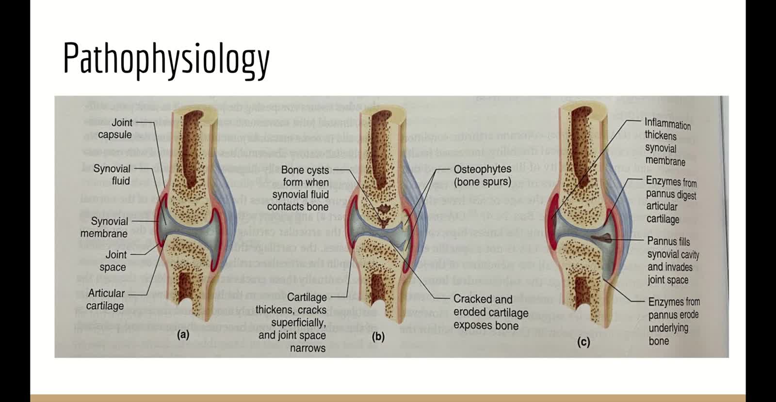 Professional Practice Tool: Osteoarthritis