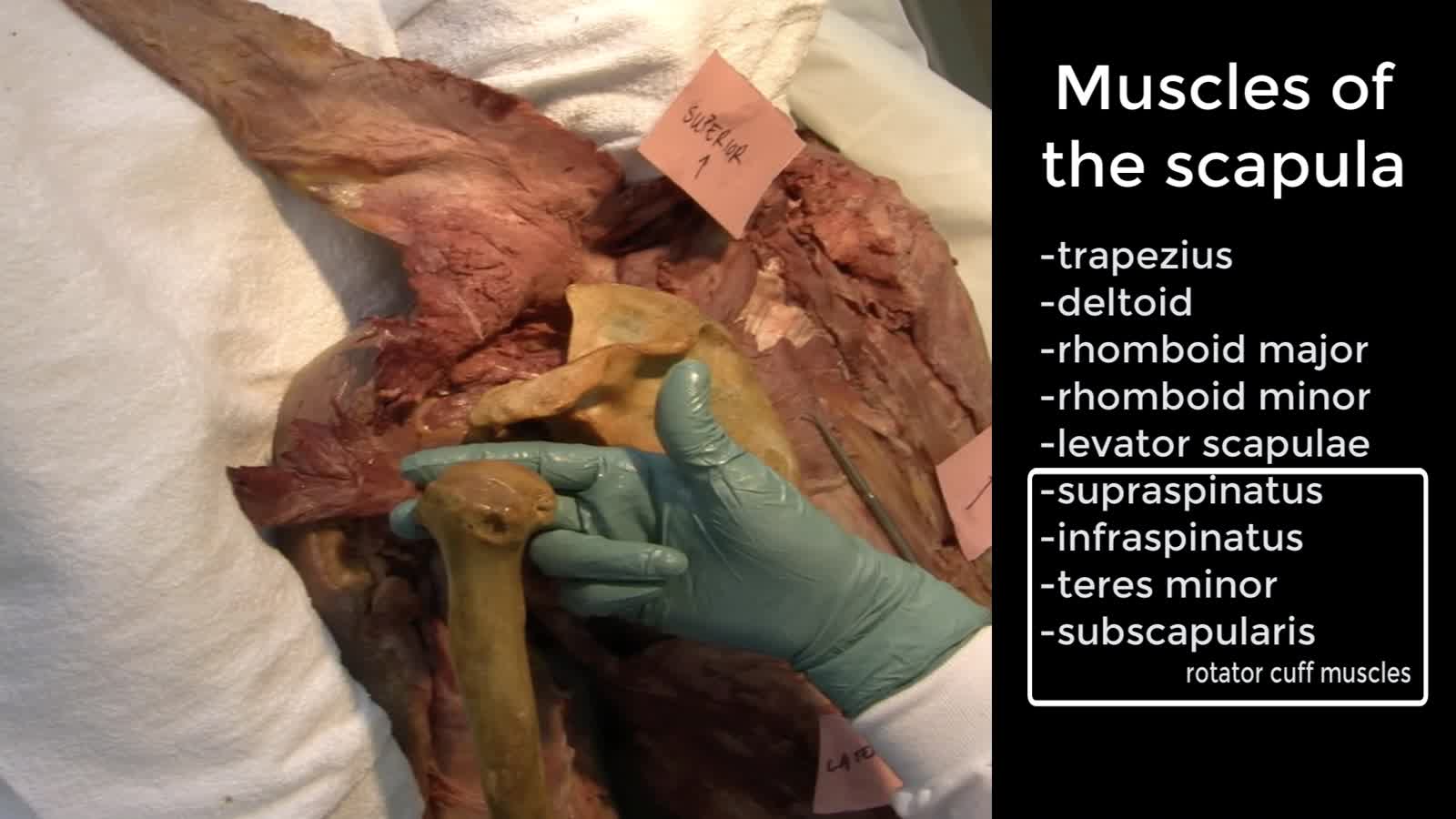 UE1 Deltoscapular Region