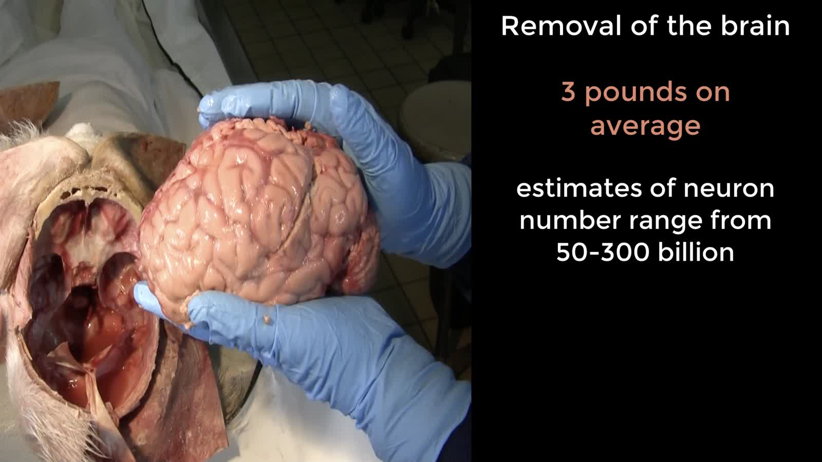 HN1 Brain Removal, Cranial Nerves, and Meninges (vers 2)