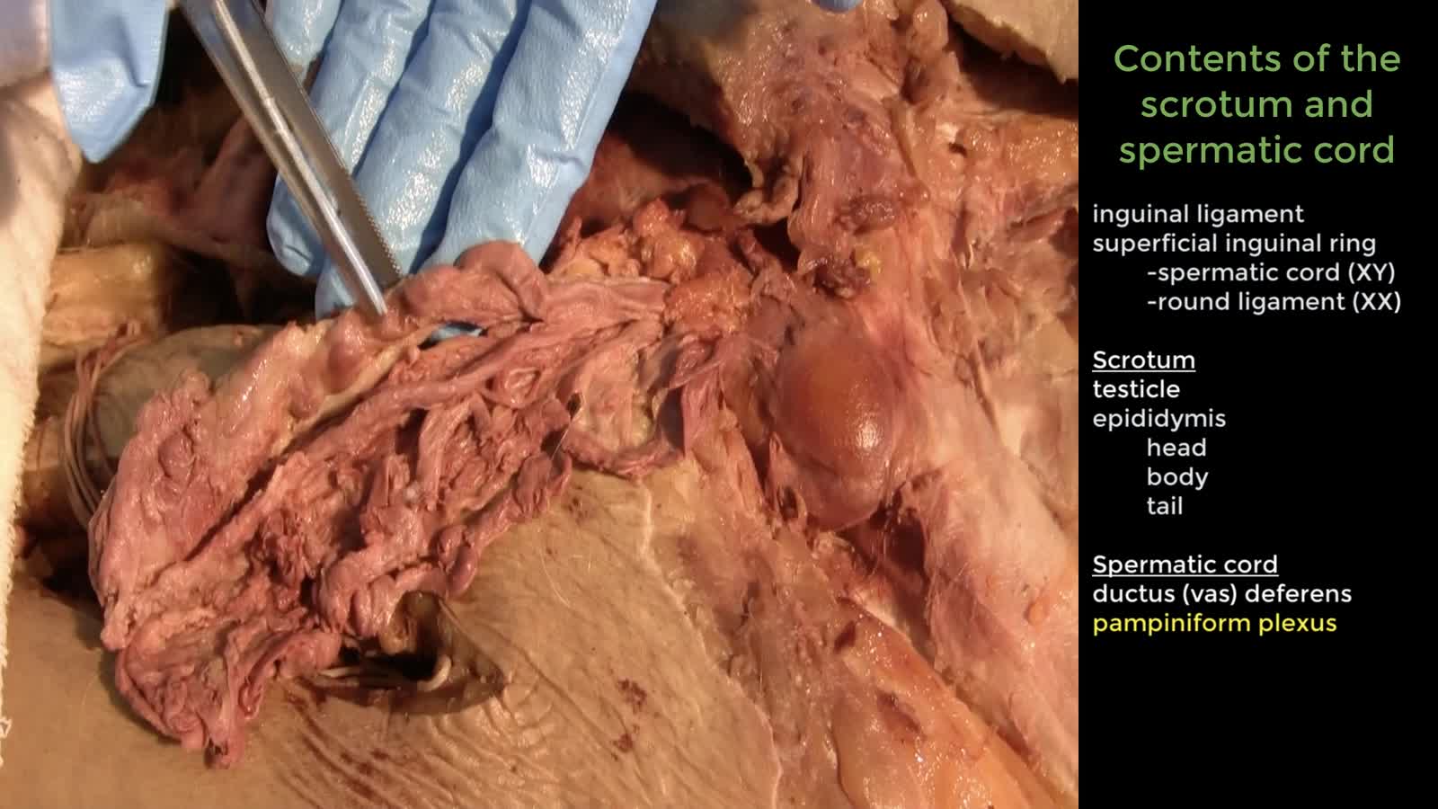 AP1 Anterior Abdominal Wall