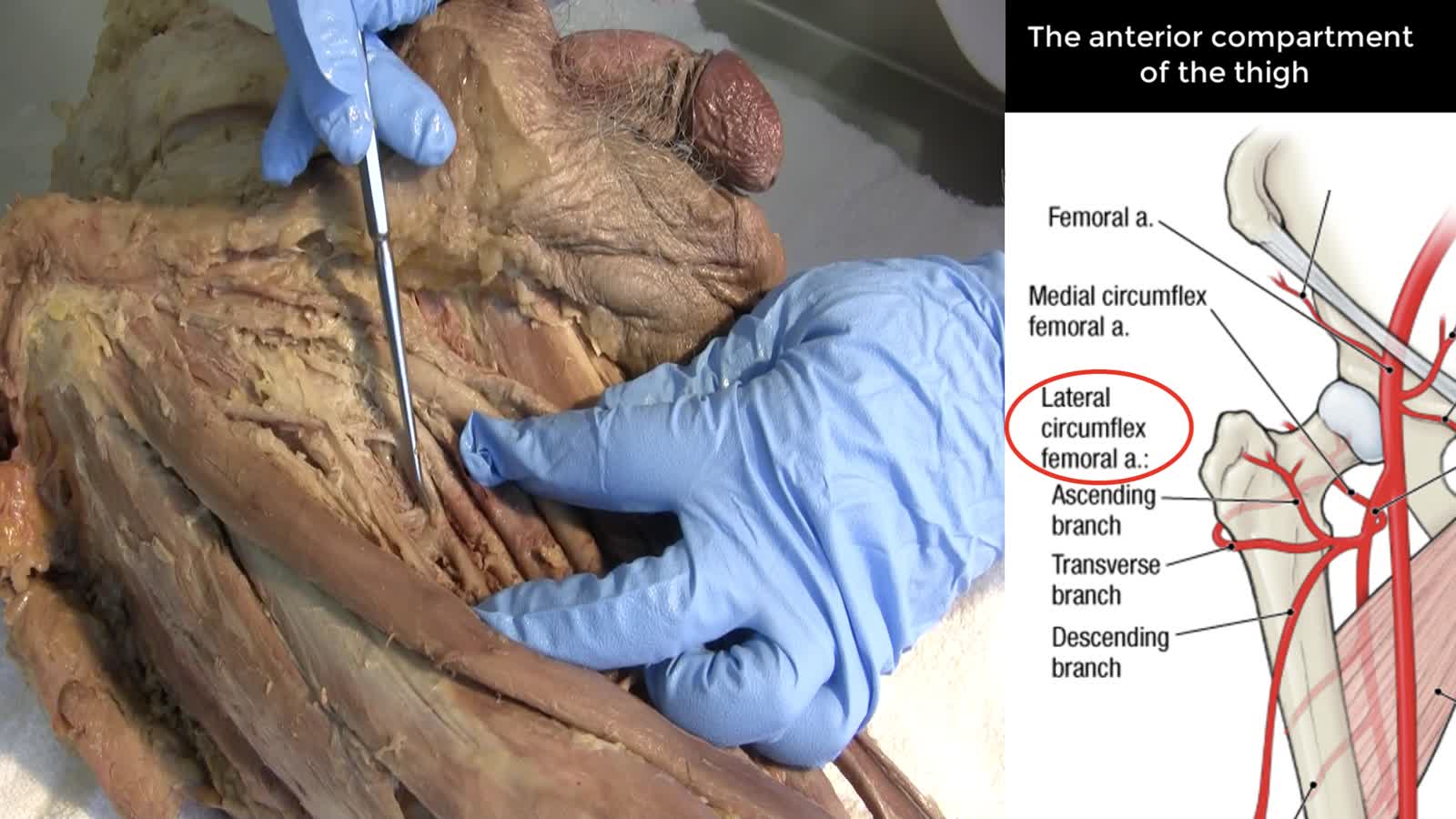 LE1 Anterior and Medial Thigh