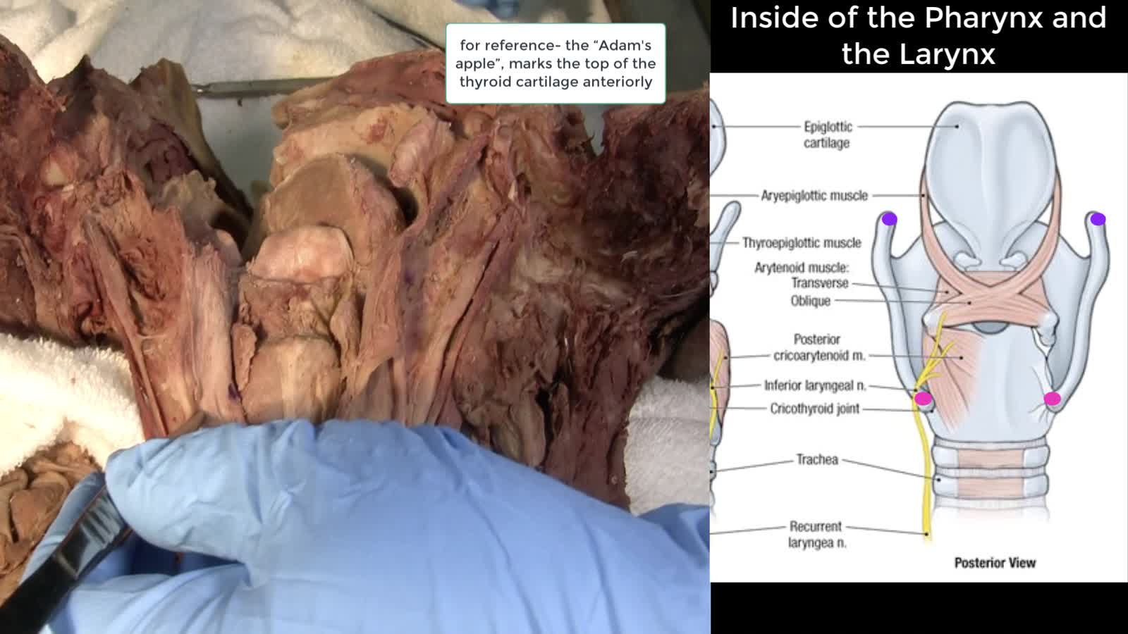 HN5 The Tongue, Pharynx, and Larynx