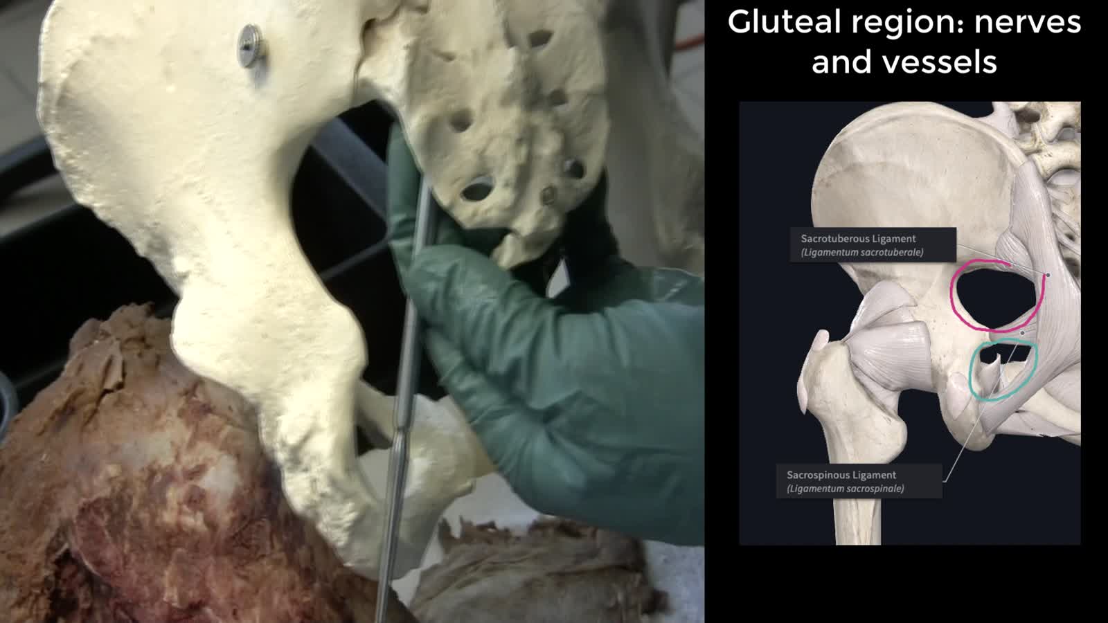 LE2 Gluteal Region and Popliteal Fossa