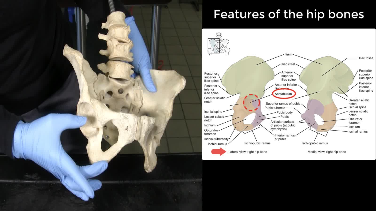 AP0 Unit 3 Bones