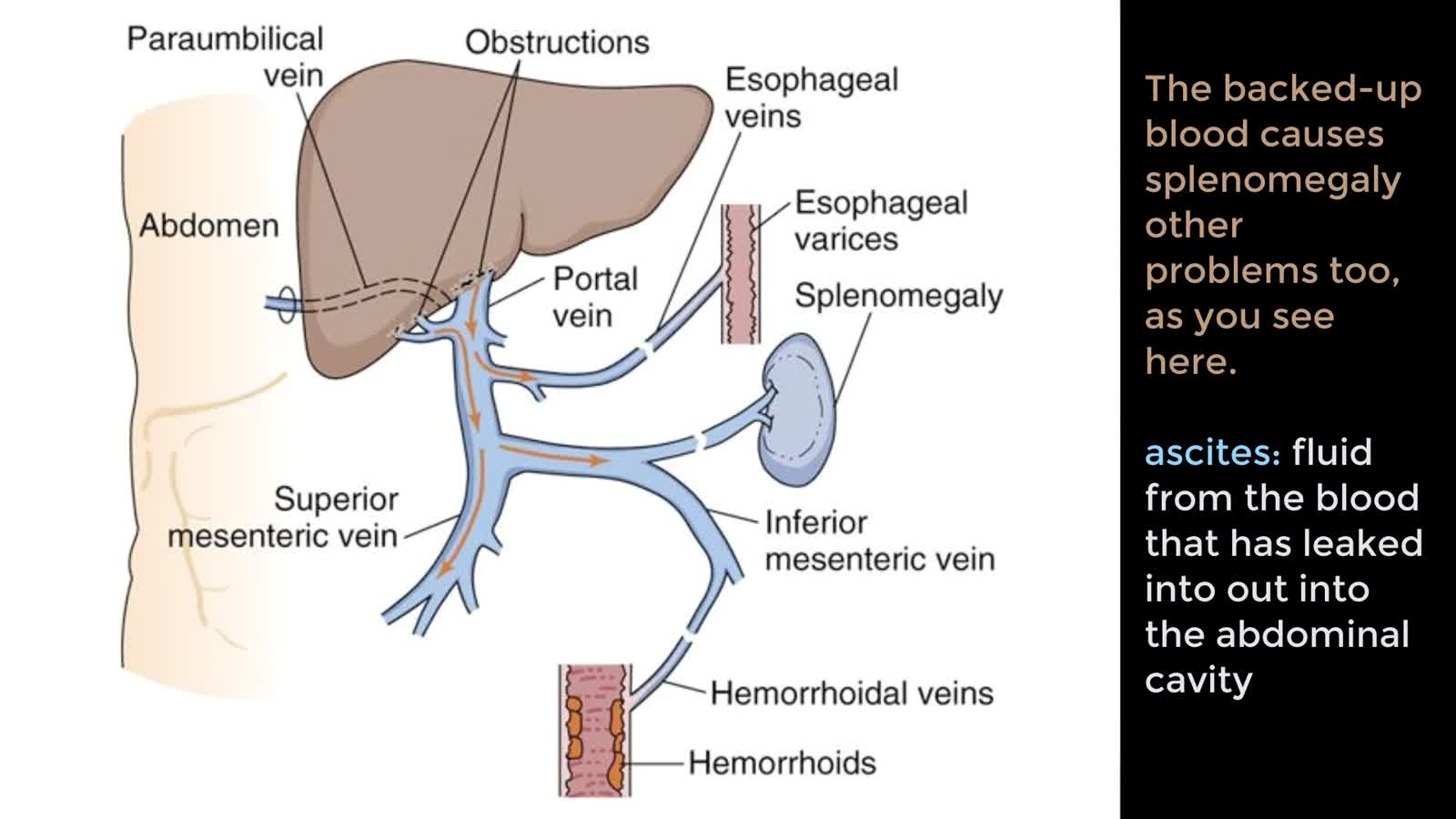 APX Liver Pathology